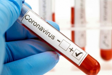 Coronavirus en Corrientes: Confirman un nuevo caso en Capital y suman 214 los positivos en la Provincia.