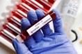Corrientes superó la barrera de los 600 casos: Se sumaron 28 nuevos contagios de Coronavirus.